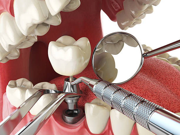 Best Emergency Denture Repair in Unadilla, GA